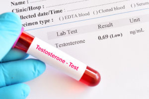 Low Testosterone/Testosterone Deficiency